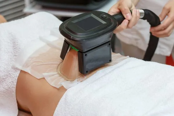 Image of person having fat freezing treatment to help weight gain Wisbech