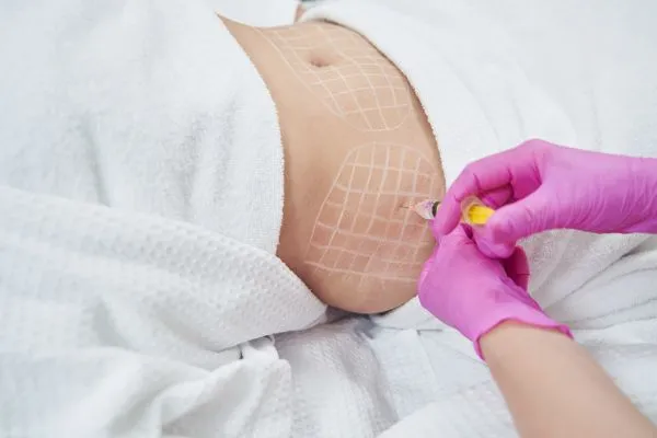 image of fat dissolving injections on love handles to help combat weight gain Wisbech